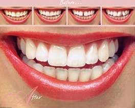 sorriso perfeito